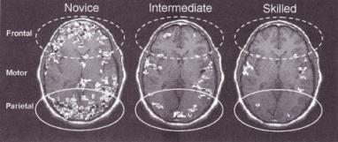 Brain Scan